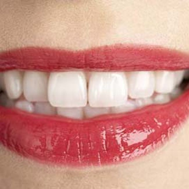 tratamientos implantes dentales