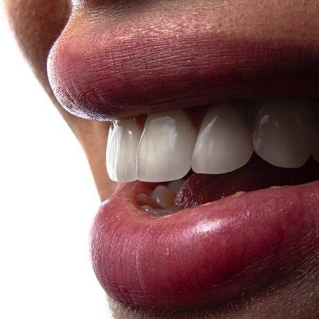Estética dental