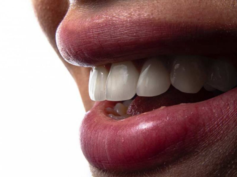 estetica dental