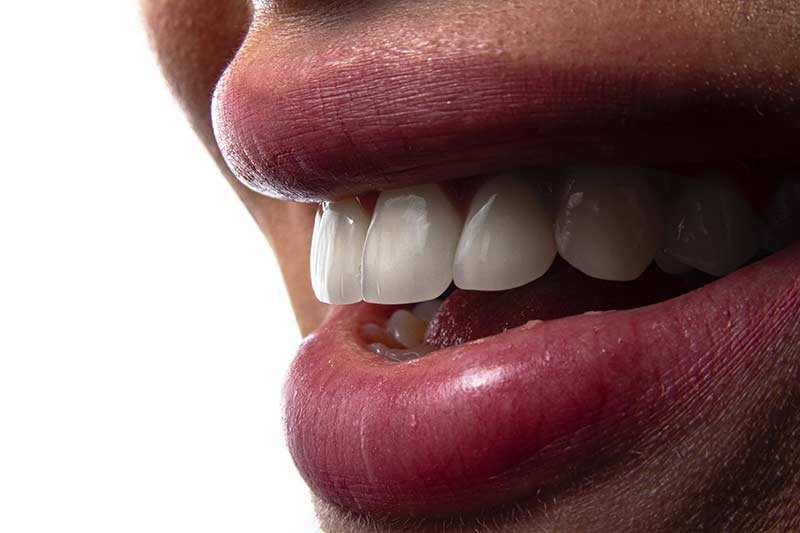 Estética dental